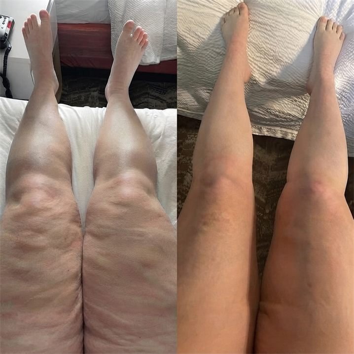 Melissa T. — before and after