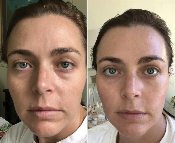 Amanda K. — before and after
