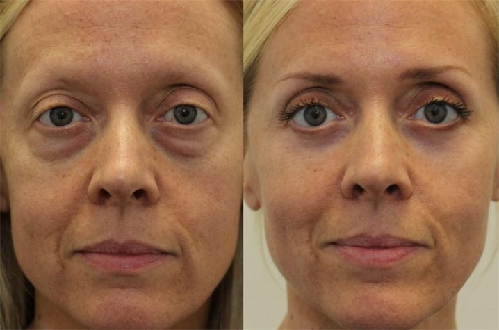 Rebecca T. — before and after